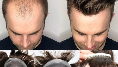 Mens Hair Systems