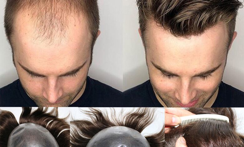 Mens Hair Systems