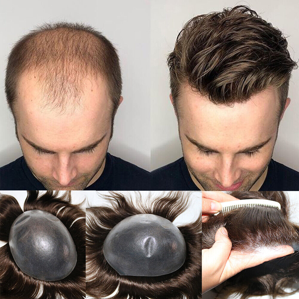 Mens Hair Systems