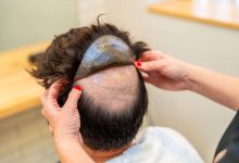 best Hair systems for men