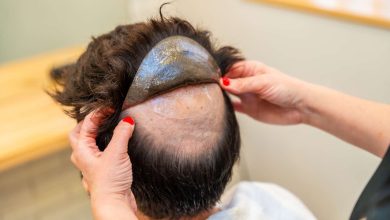 best Hair systems for men
