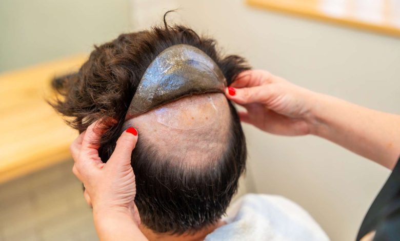 best Hair systems for men