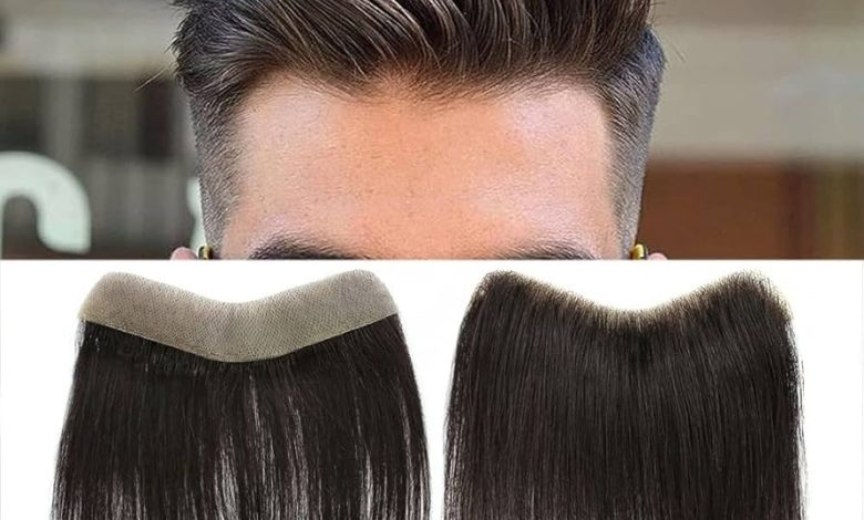 Hair systems for men